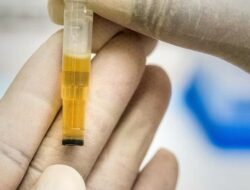 Protein dalam Urine: Tanda Penyakit Ginjal atau Hanya Masalah Sepele?
