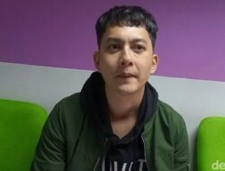 Rahasia Kiki Farrel Merawat Rambut Hasil Transplantasi Agar Tetap Sehat